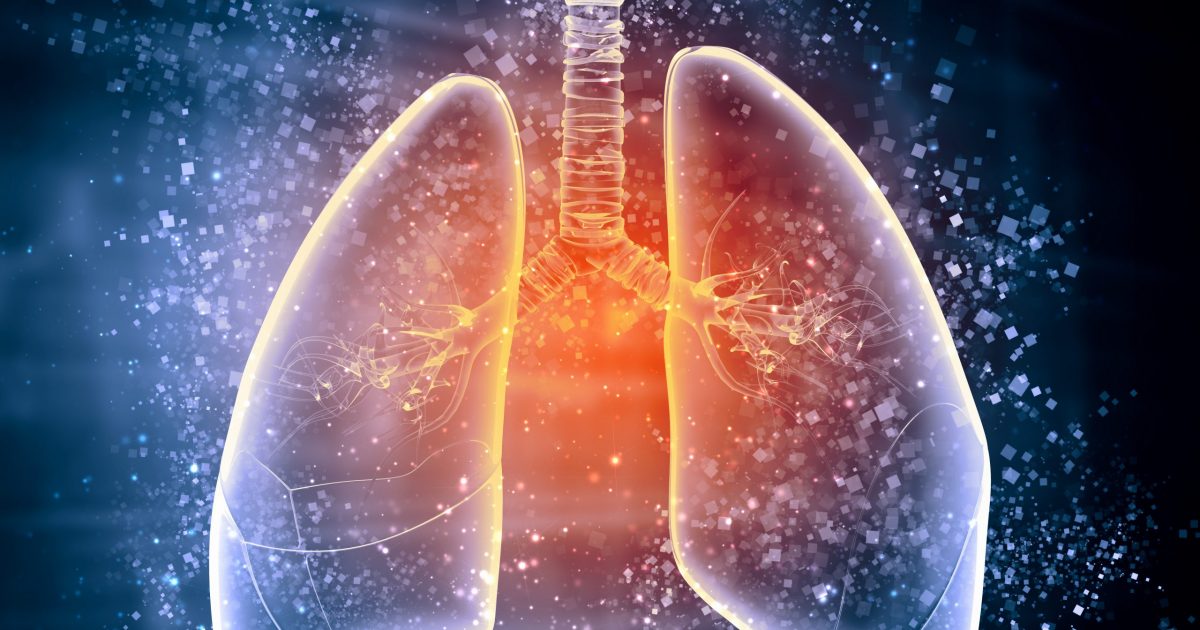 IPF Progression Linked to High Number of Bacteria in Lungs – Pulmonary ...