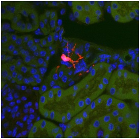 A Gli1 progenitor cell (red) located in a healthy  kidney. During fibrosis these cells differentiate into  myofibroblasts, causing scarring and organ failure. Photo credit: Rafael Kramann, MD