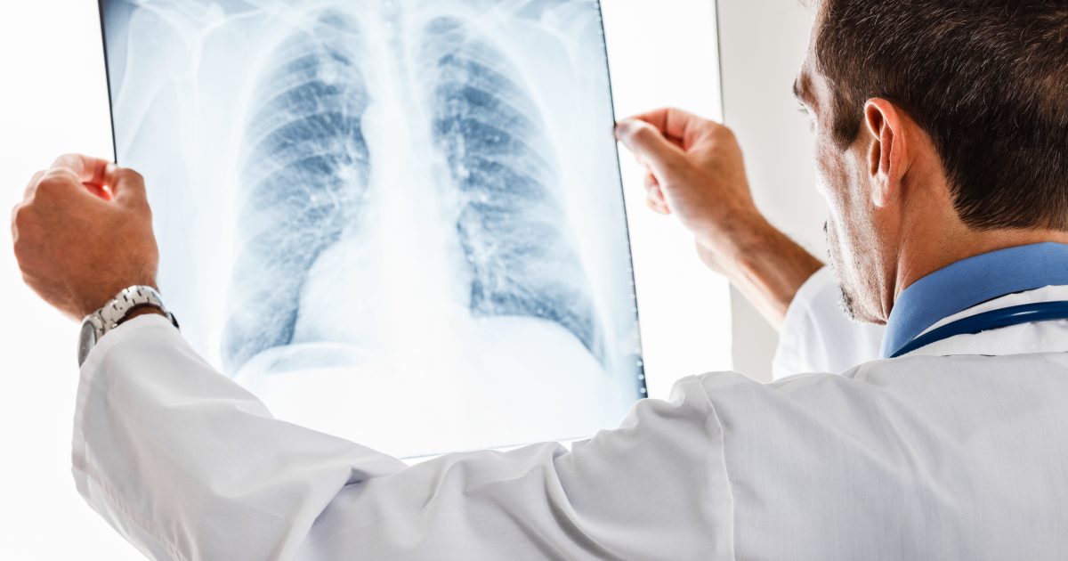 Pulmonary Fibrosis Foundation Sets Scientific Record at Upcoming Summit