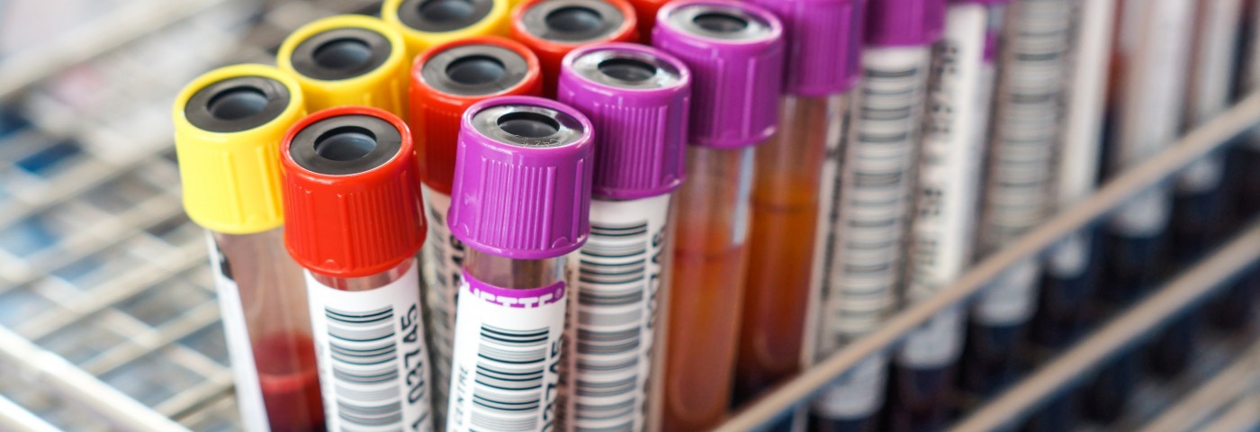 Potential IPF Disease Biomarkers Seen in Patients' Blood