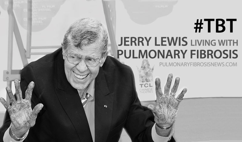 PF Jerry Lewis1