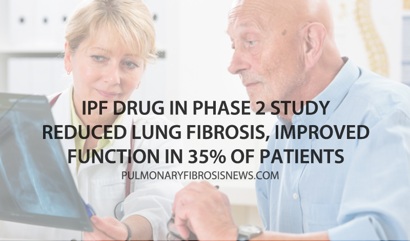 ipf lung fibrosis