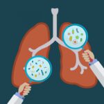 chronic lung infections