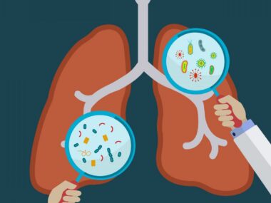 chronic lung infections