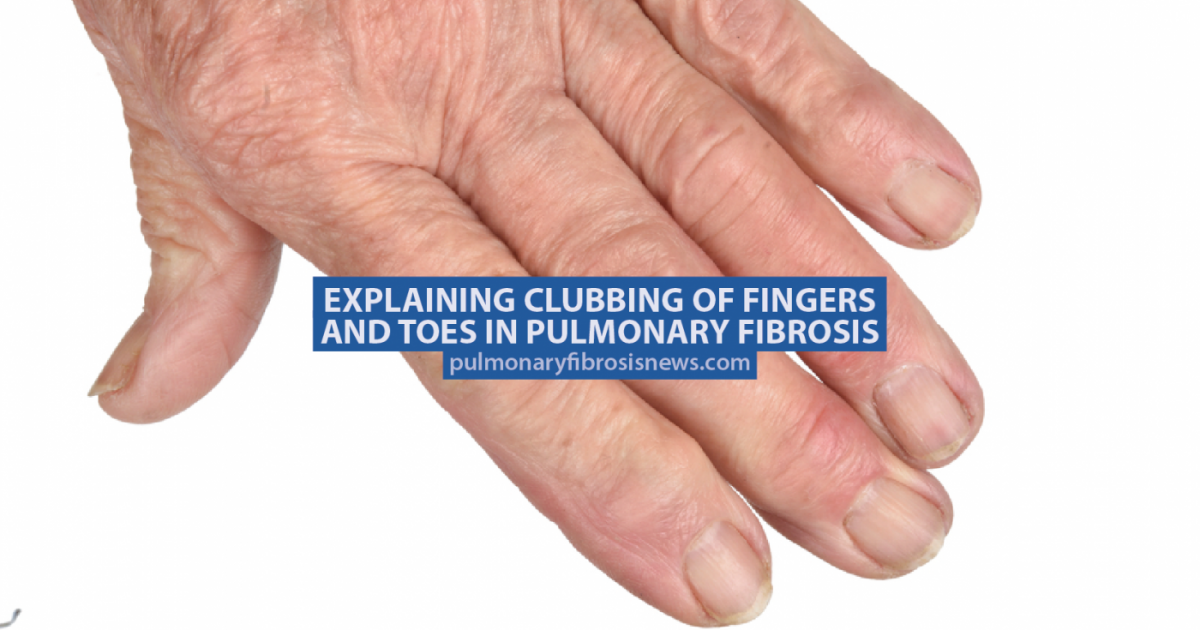 Fingernails Reveal A Lot About Your Health - Healthy Holistic Living