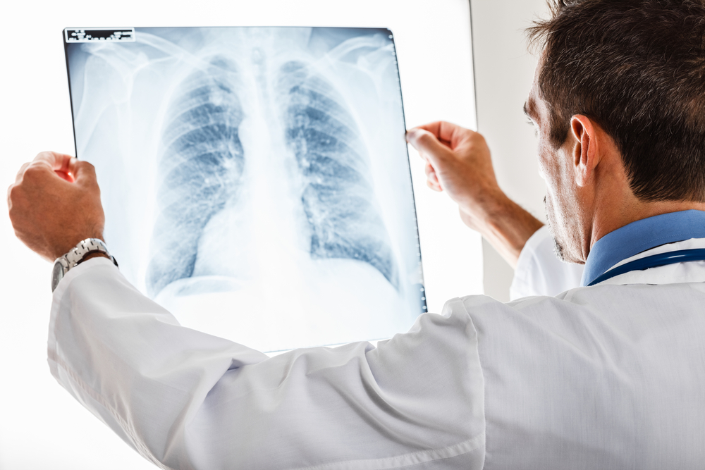 lipids, pulmonary fibrosis