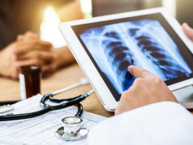 prognosis in IPF