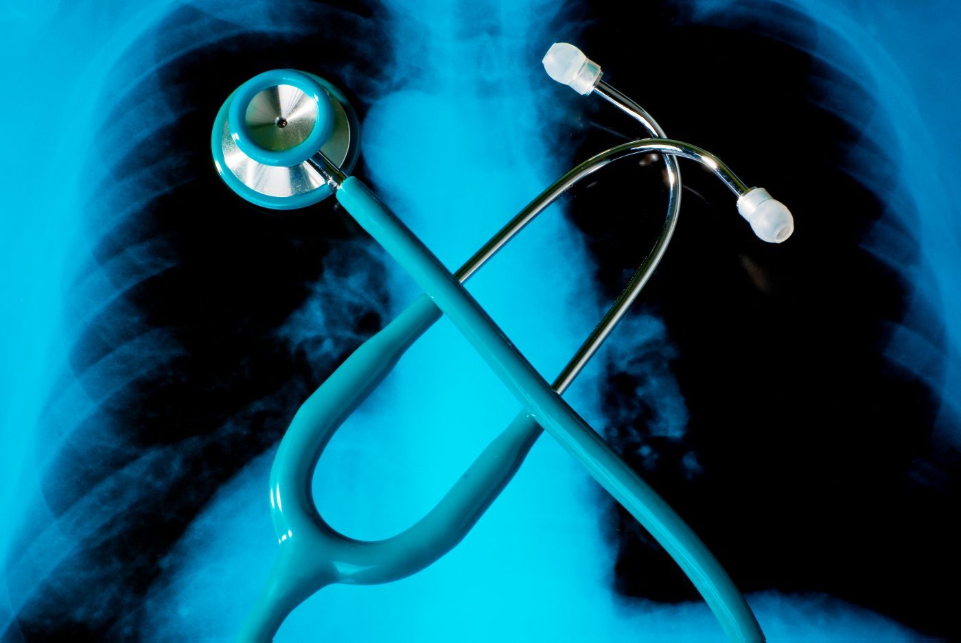 Pulmonary Fibrosis Ups Risk Of Pneumonitis For Some With Lung Cancer