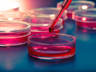 MDM4 protein and IPF