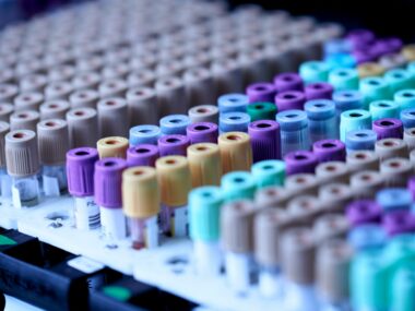 myofibroblast role in PF | Pulmonary Fibrosis News | test tubes in preclinical study