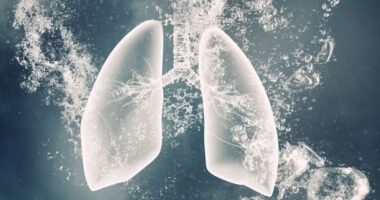 new IPF subtype/pulmonaryfibrosisnews.com/computerized imaging scan helps ID