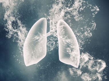 new IPF subtype/pulmonaryfibrosisnews.com/computerized imaging scan helps ID