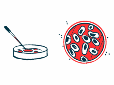 A dropper is poised over one petri dish next to an aerial view of another petri dish in this illustration.