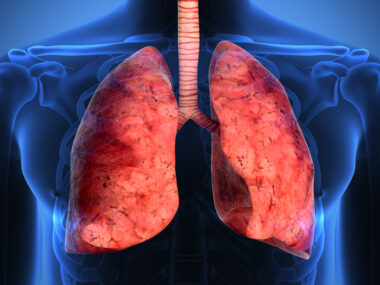 pulmonary rehabilitation | Pulmonary Fibrosis News | A stock photo showing a graphic rendering of a person's lungs.