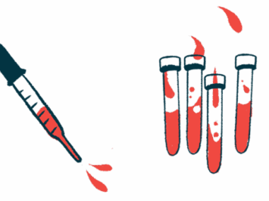 A dropper squirts blood alongside several half-filled vials.