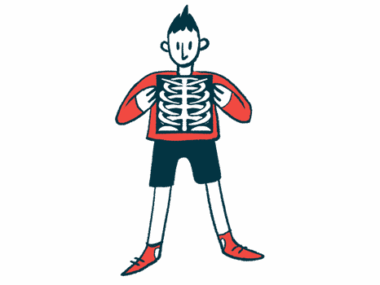 A person holds an X-ray image at chest level in this illustration.