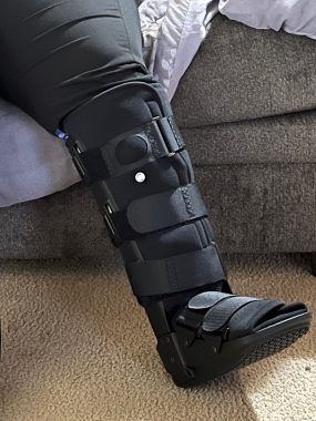 being a caregiver | Pulmonary Fibrosis News | photo of a boot on an injured leg