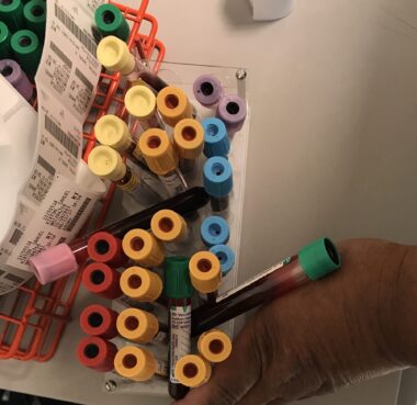 An overhead shot of dozens of lab tubes filled with blood. The tube tops are color-coded with green, yellow, purple, blue, red, pink, and orange.
