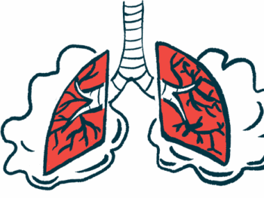 An illustration shows a pair of lungs struggling to breathe.